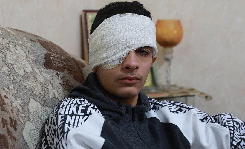 İsrail askerlerinin vurduğu Filistinli çocuk gözünü kaybetti