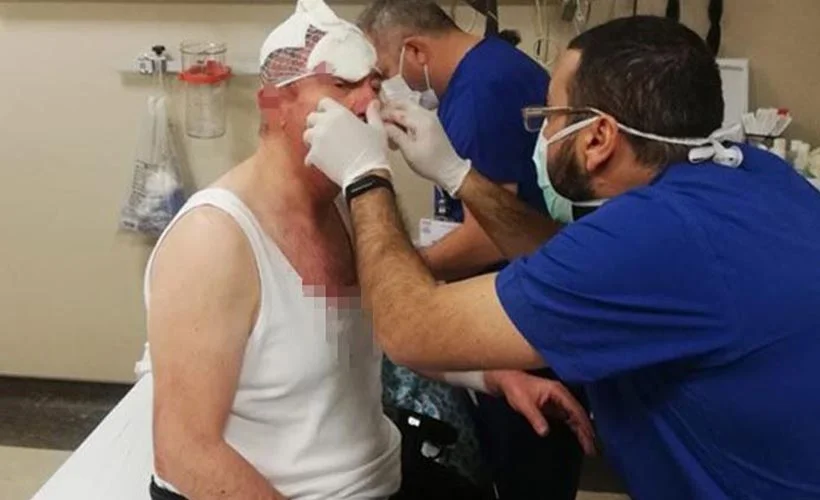 Selçuk Özdağ'a saldıran 2 şüpheli gözaltına alındı