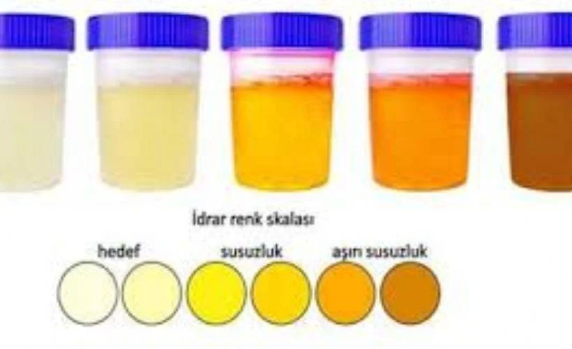 İdrar rengi neden değişir? İdrar rengini hangi besinler etkiler? Günde ne kadar su tüketmeli?