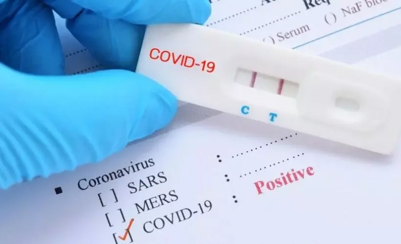Koronavirüs testi nerede yapılır? Korona testi eczanede satılıyor mu?