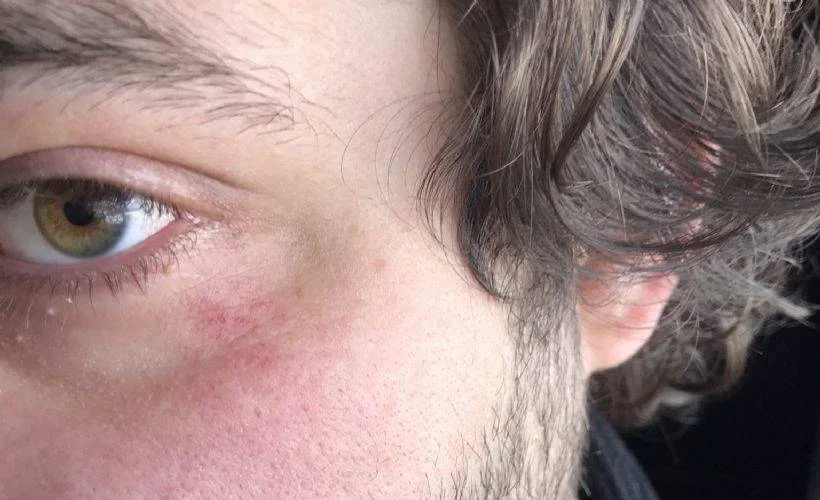 2 dakika erken kalkan otobüs şöförünü uyardı diye dayak yedi
