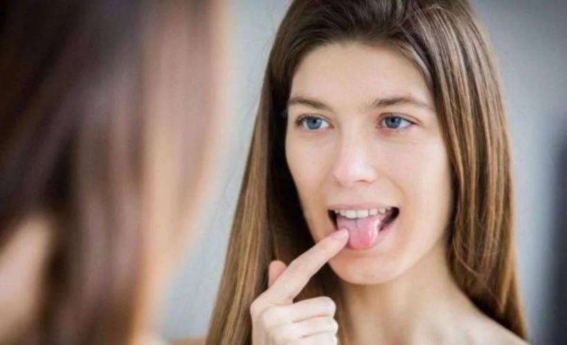 Dil uyuşması neden olur? Dil uyuşması için hangi doktora (bölüme) gidilir?