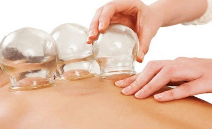 Hacamat hangi hastalıklara iyi gelir? 2021 Hacamat hangi günlerde yapılır?