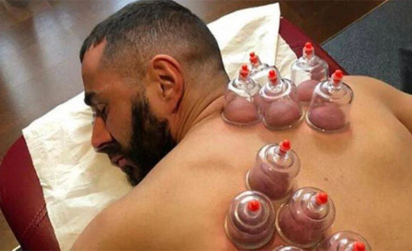 Hacamat nedir? Hacamat sinüzite iyi gelir mi?