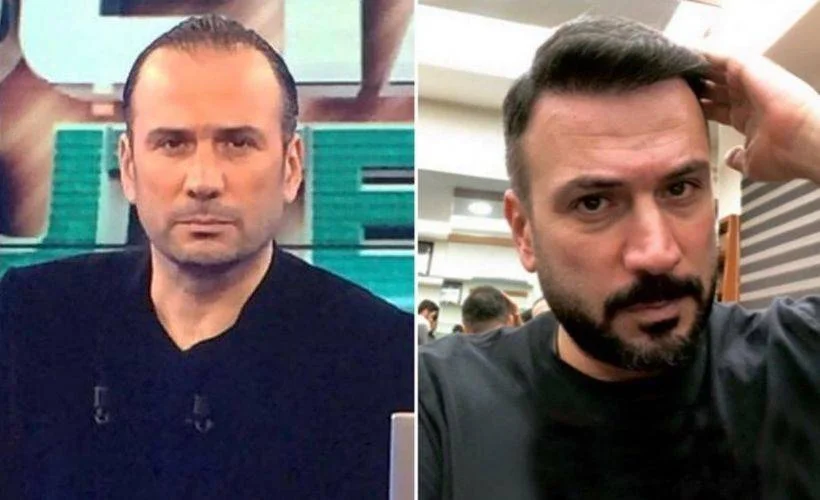 İstanbul Hairline CEO'su Gülşen Şener, "Saç ekimi ile kalıcı, doğal görünümlü saçlara sahip olmak hayal değil."