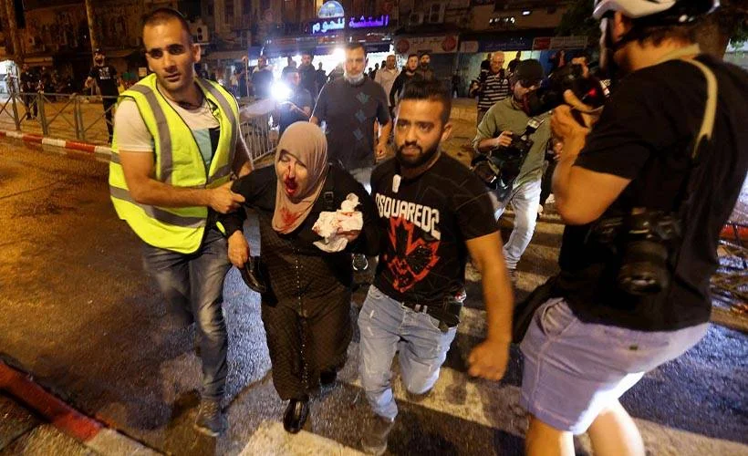 Yaralı Filistinli sayısı 305'e yükseldi