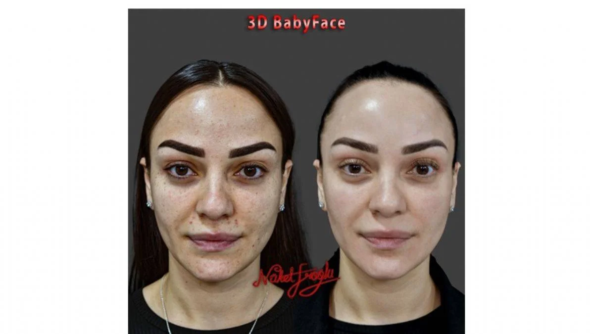 Dr. Nüket Eroğlu, dolgu, botilismus toksini, endopeel, gibi uygulamalar yaparken altın oranın önemini vurguladı