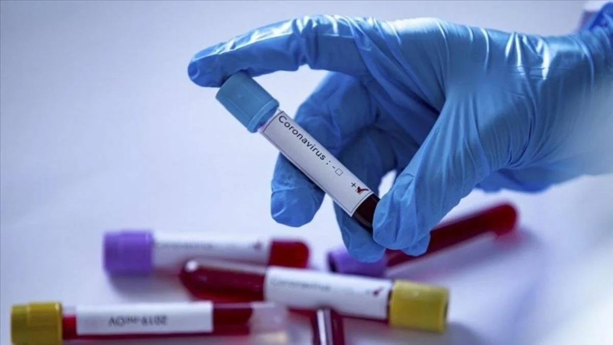 Dünya genelinde koronavirüs vaka sayısı 200 milyonu aştı