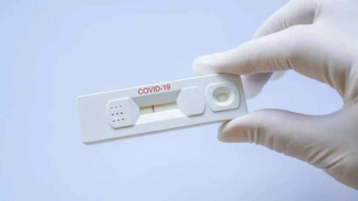Sağlık ocağında PCR testi yapılır mı? Korona testi nerelerde yapılır?