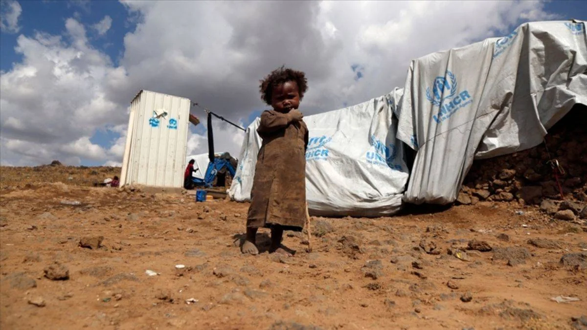 Yemen'de acı tablo: 10 dakikada 1 çocuk ölüyor