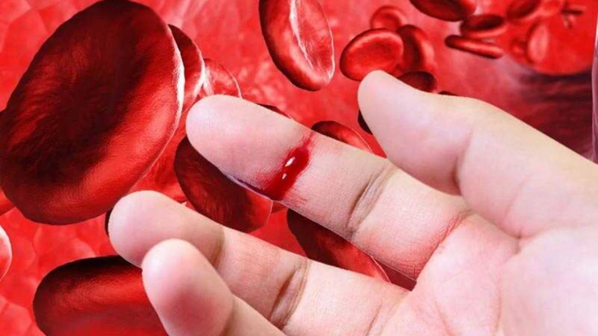 Çocuğunuzun kanamalarını bir türlü durmuyorsa hemofili olabilir
