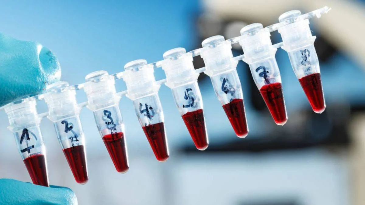 Ücretsiz SMA testi ne zaman başlayacak? SMA taşıyıcı tarama testi başladı mı?