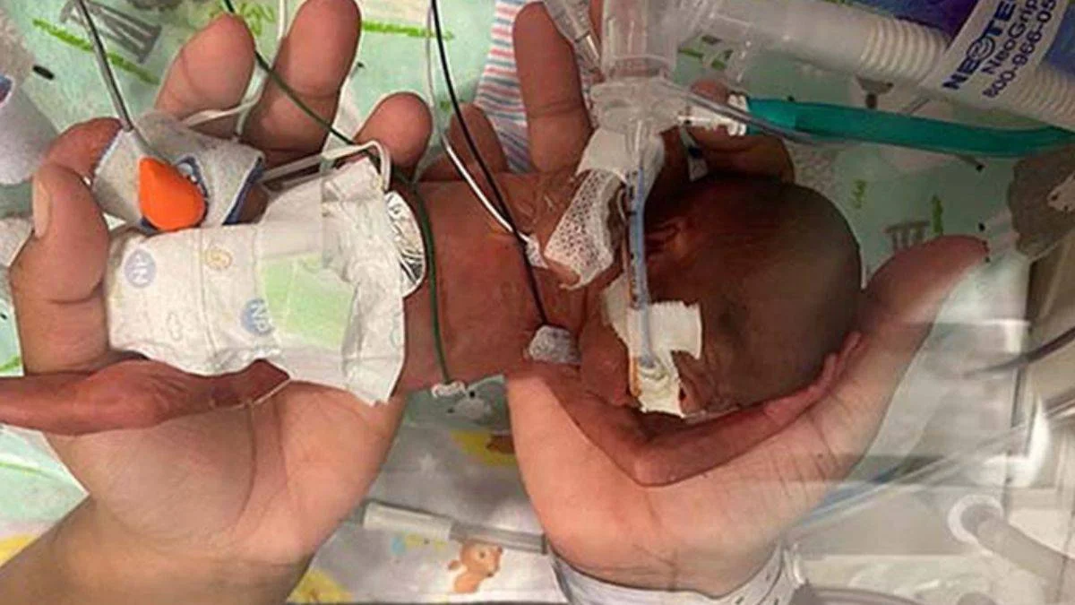 Mucize bebek: 16 haftalıkken dünyaya geldi, Guinness'e girdi!
