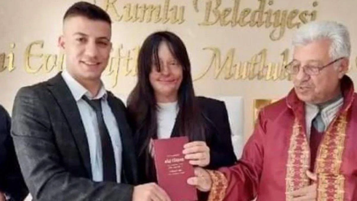 Berfin Özek, yüzüne kezzap atan eski sevgilisi ile evlendi