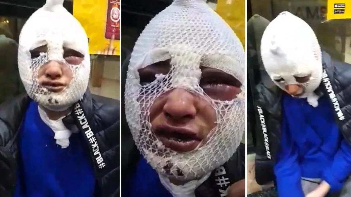 Eski sözlüsünün başından aşağı kızgın yağ döken saldırgan tutuklandı