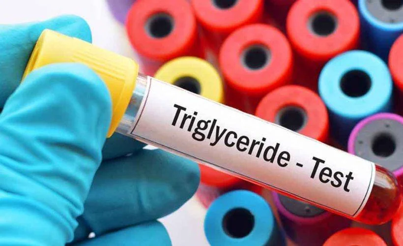 Trigliserid ne yükseltir? Trigliseridi düşüren yiyecekler nelerdir?