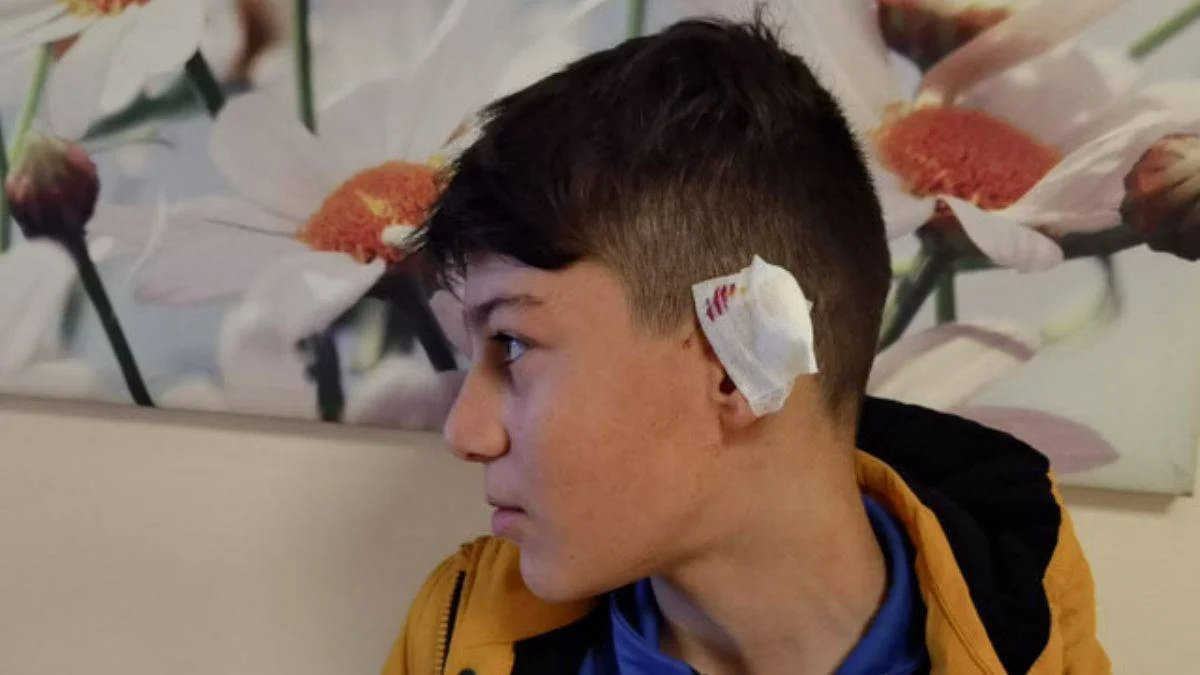 Alman çoban köpeği saldırdı