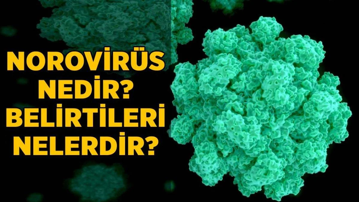 Norovirüs nedir? Norovirüs belirtileri neler? Norovirüs öldürücü mü?
