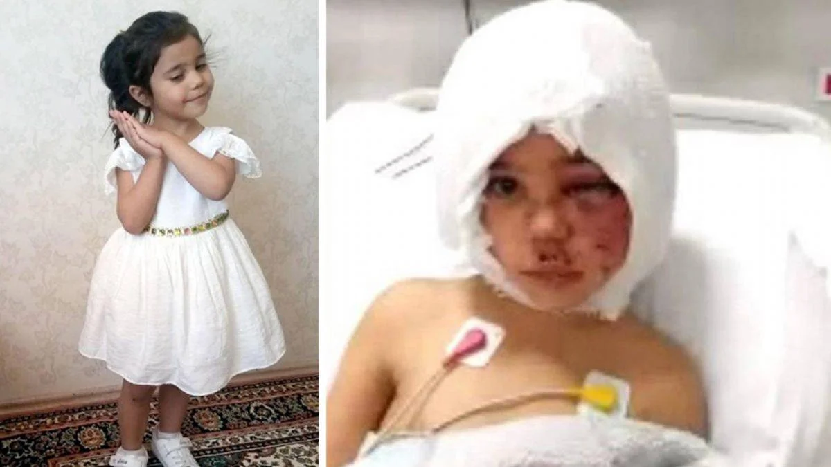 Pitbull saldırısına uğrayan Asiye'den haber var! İşitme sorunu giderildi, haftaya taburcu