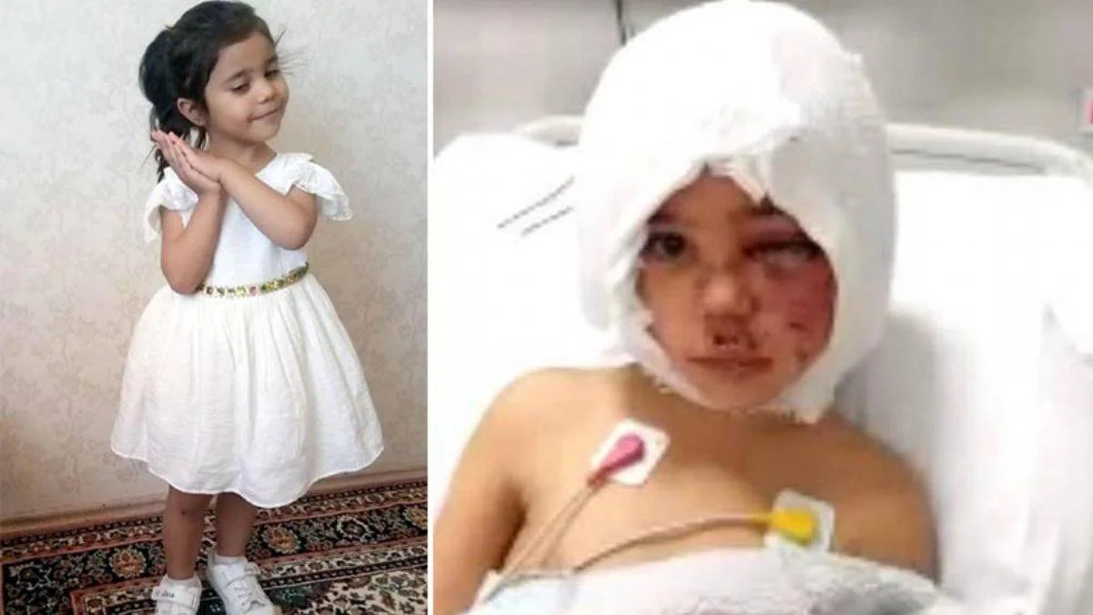 Rektör Özkan, Asiye'nin son durumunu açıkladı