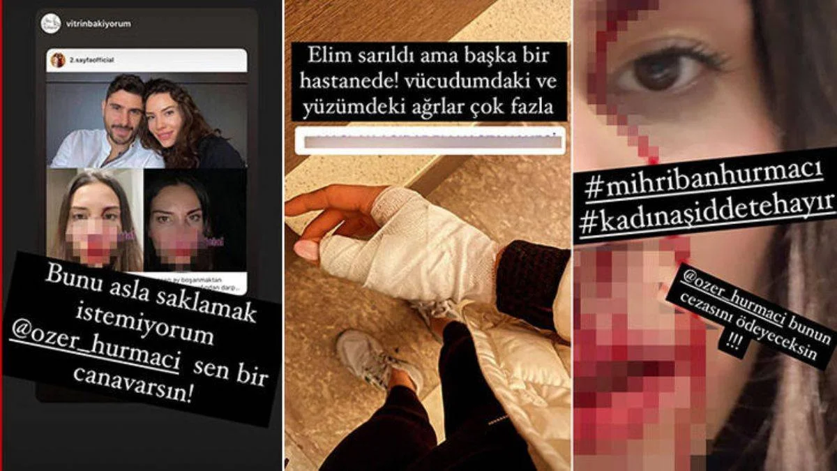 Özer Hurmacı'dan şiddet iddialarına yanıt