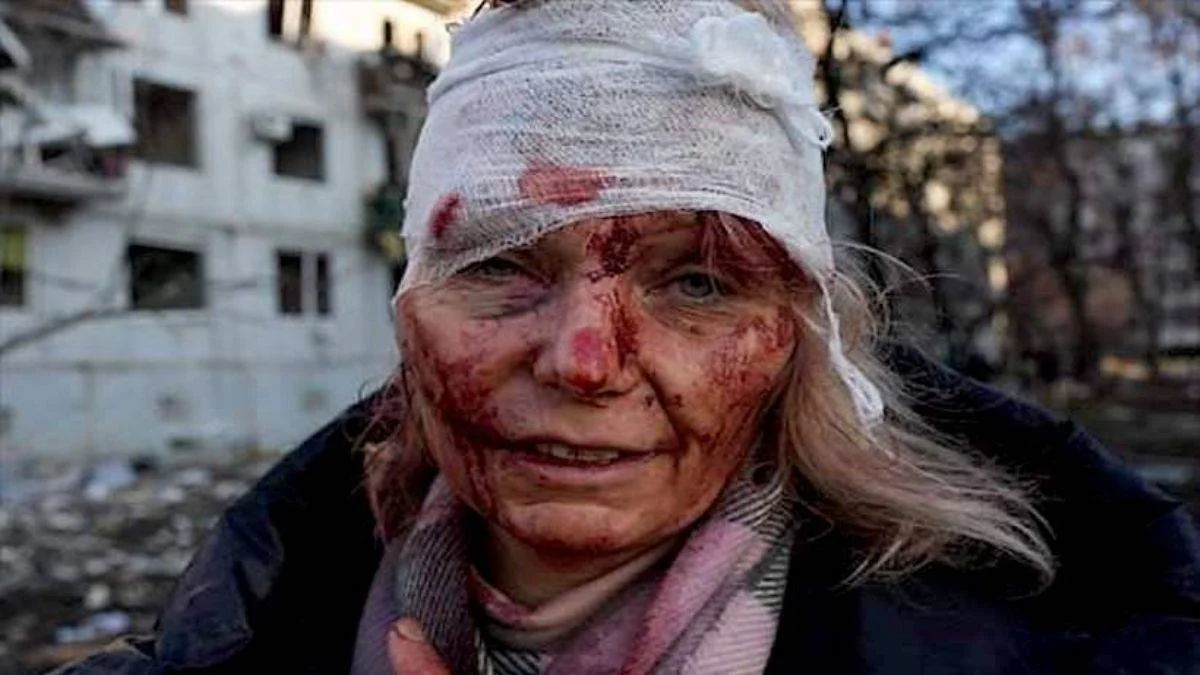 AA muhabirinin çektiği, Ukrayna savaşının 'simge' fotoğrafının resmedildiği tablo 100 bin dolara satıldı