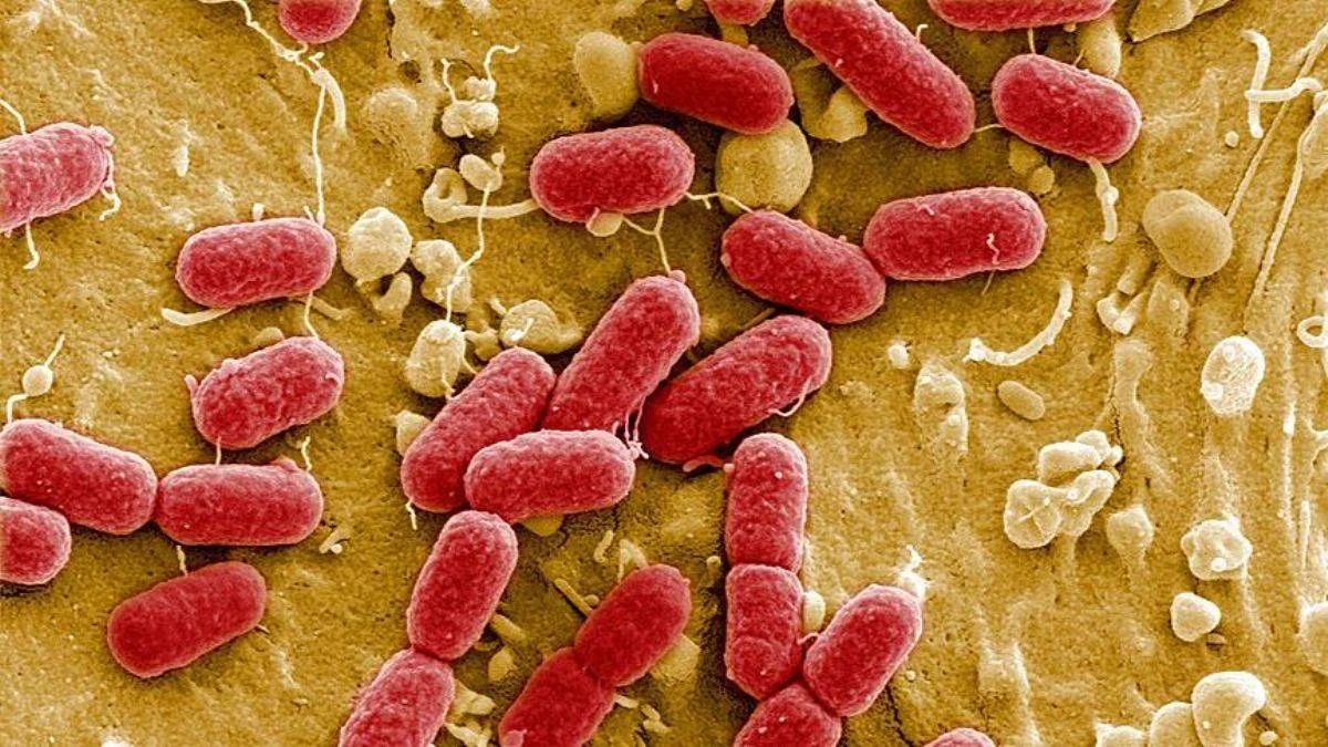 Salmonella hastalığı nedir? Salmonella nasıl bulaşır, nasıl tedavi edilir? Salmonella öldürür mü?