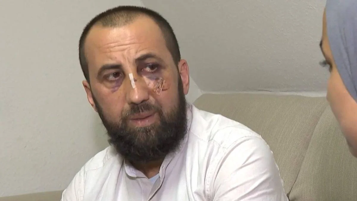 Almanya'da yaşayan Türk'e polis şiddeti!