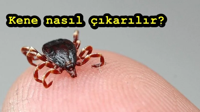 Kene nasıl çıkarılır? Zararsız kene nasıl anlaşılır? Kene zehirlenmesi kaç saatte belli olur?