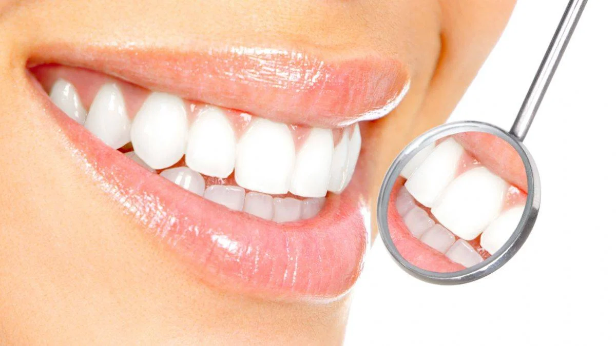 Diş beyazlatma tedavisi (Bleaching) nedir? Düğün öncesi diş beyazlatma I Dişlerim ne kadar beyazlar?