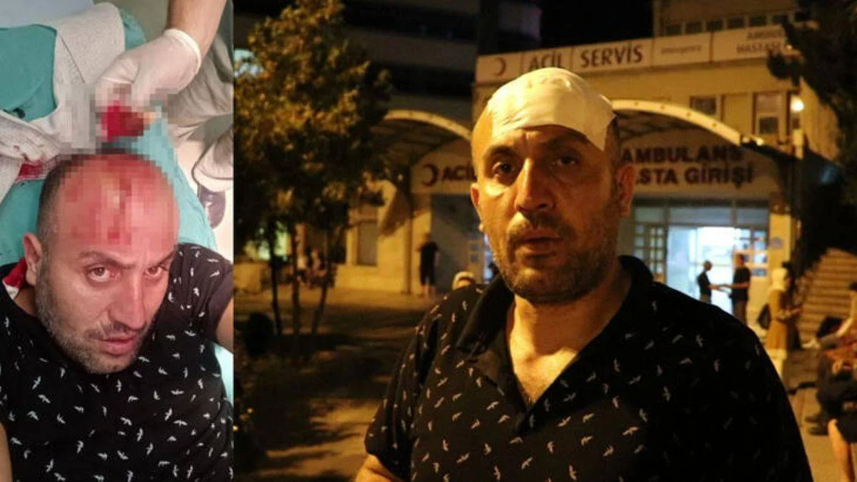 Köpeklerden kaçarken başını duvara çarptı; saldırıdan da kurtulamadı