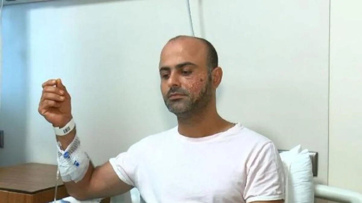 Lazer epilasyonda 'Yüzüm yandı' dedi. Merkez, 'Şeker hastası olduğunu söylemedi' diyerek savundu!