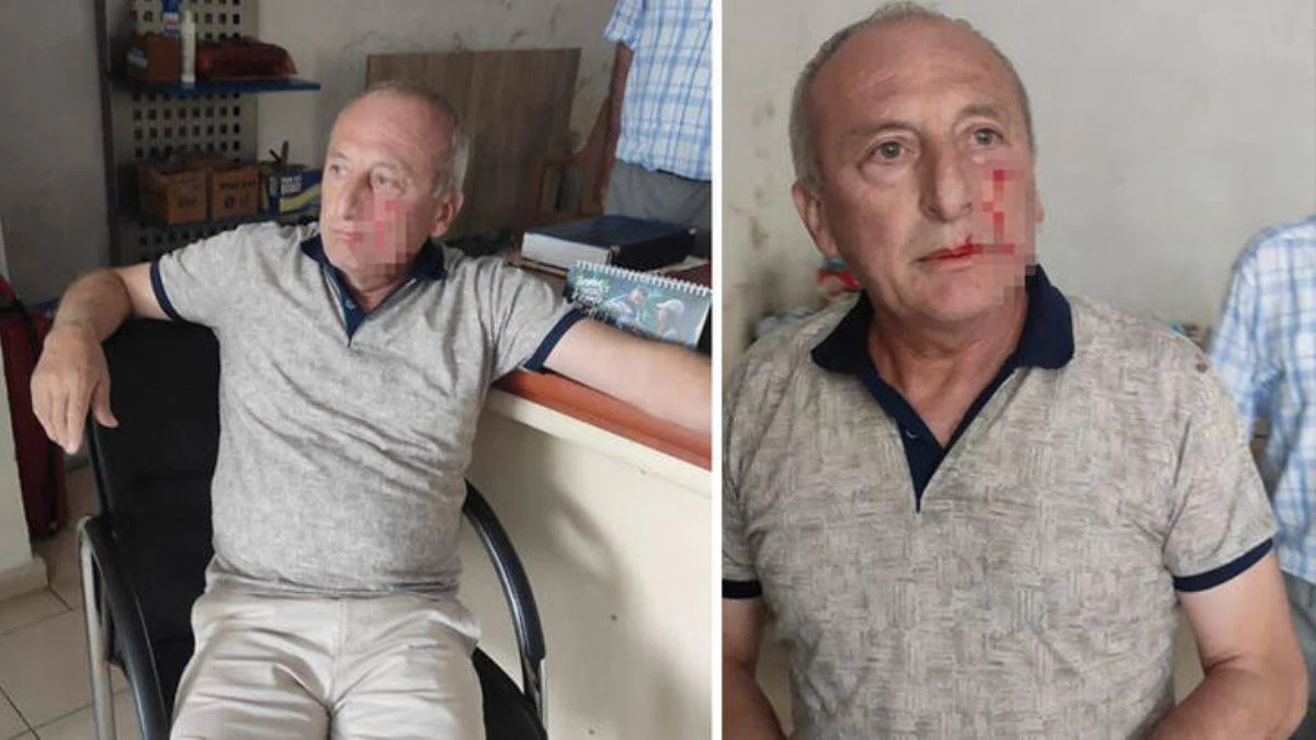 Yarbaşı Belediye Başkanı Kaynar'a yumruklu saldırı