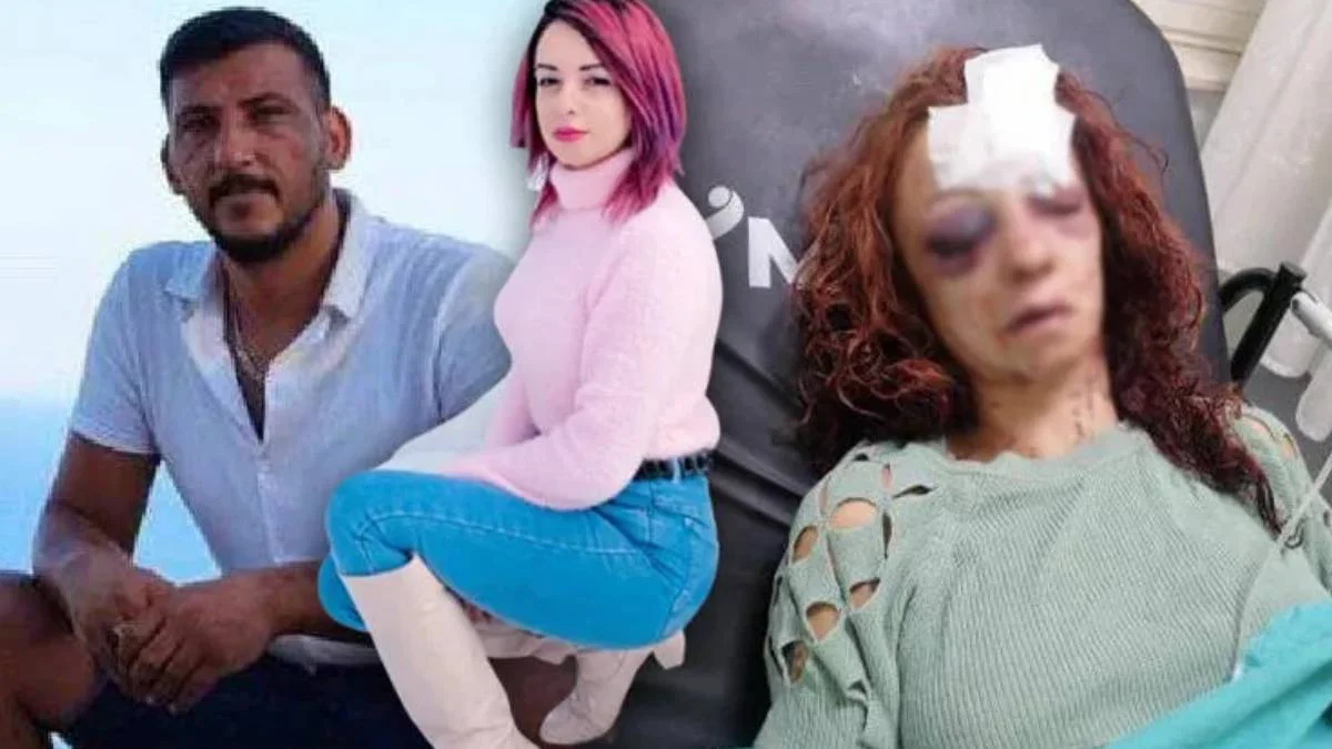 Rahime Edis kimdir? Mersin'de vahşet! Rahime Edis yaşam savaşı veriyor