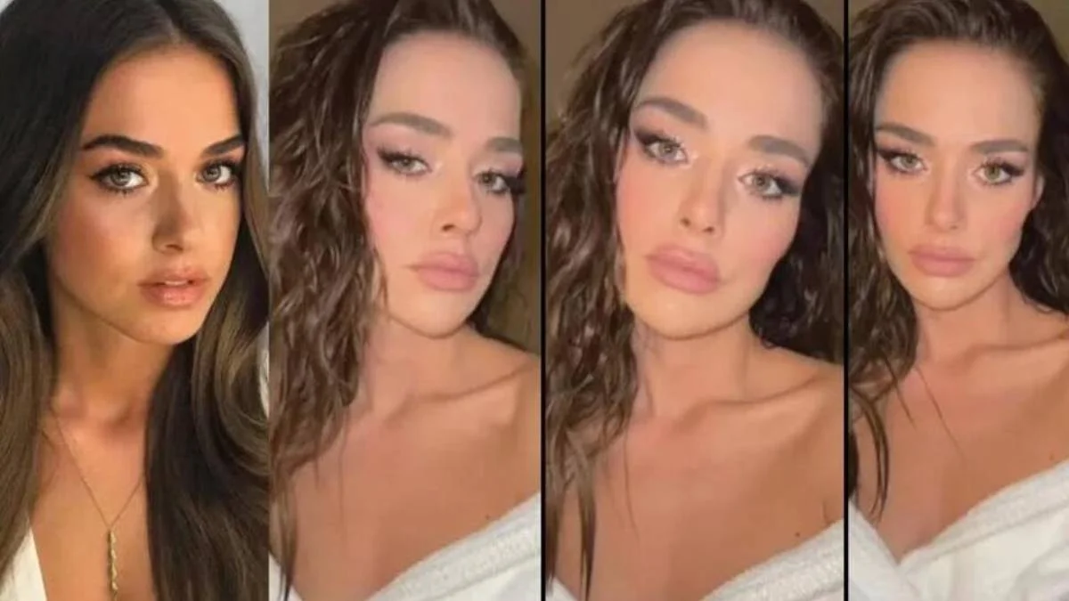 Bensu Soral'ın yüzüne ne oldu? Estetik mi yaptırdı? Bensu Soral hangi estetiği yaptırdı?