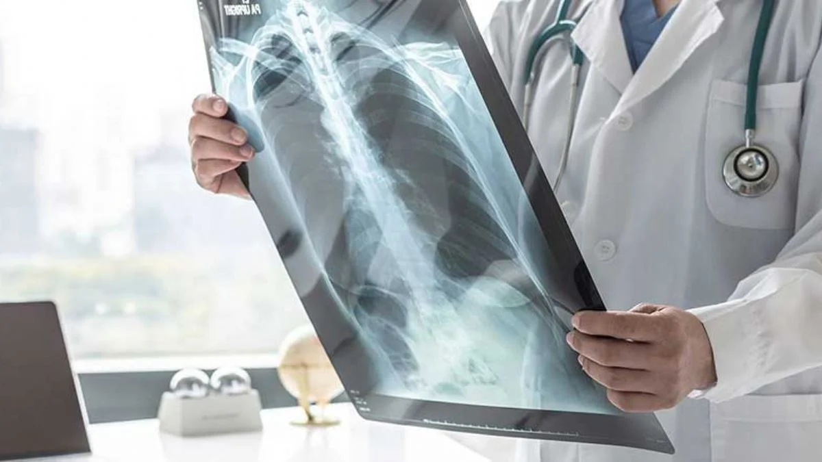 Dikkat! 55 yaş üstü ve sigara içiyorsanız mutlaka doktora başvurun