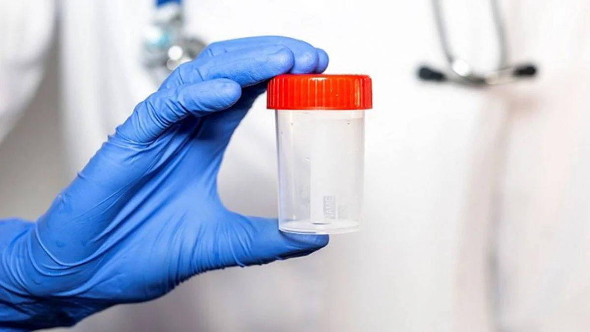 Sperm Testi