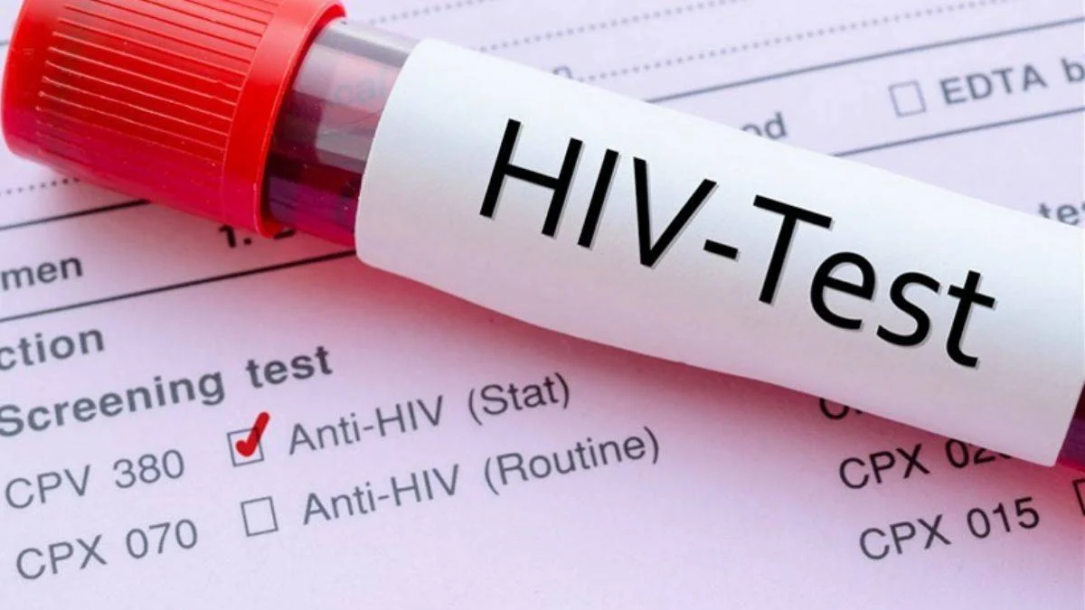 Hiv Testi