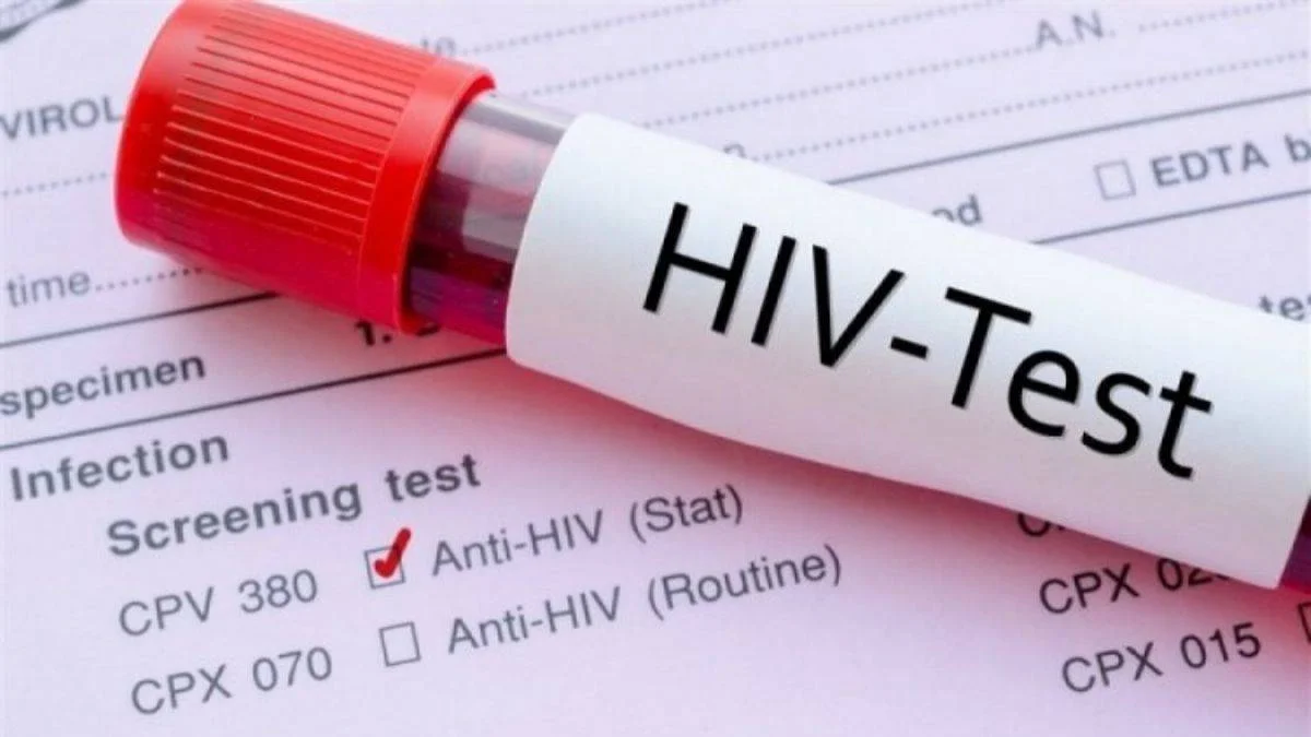 Hiv Testi Nedir? Kimler İçin Uygundur?