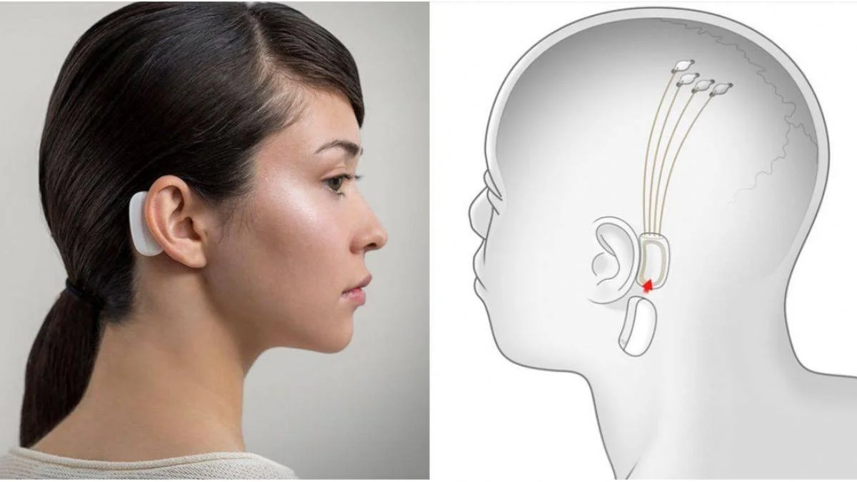 Neuralink projesi: Beyin çipiyle telepati