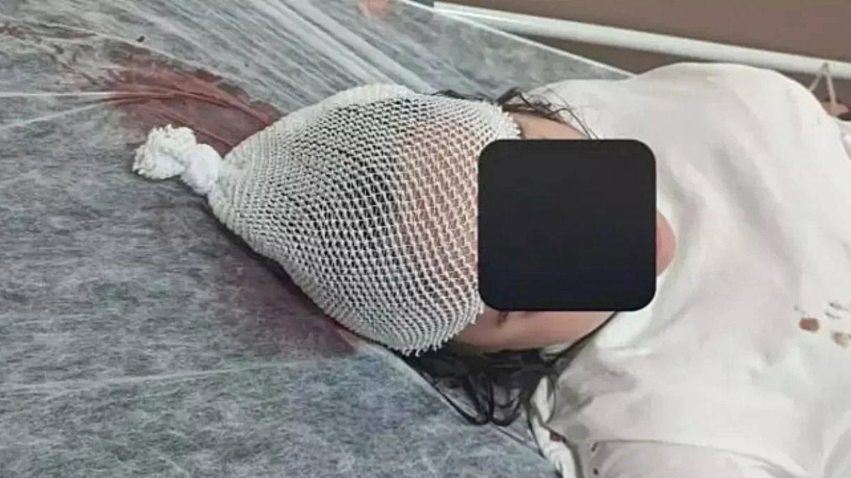 Başıboş köpek saldırısında ağır yaralandı