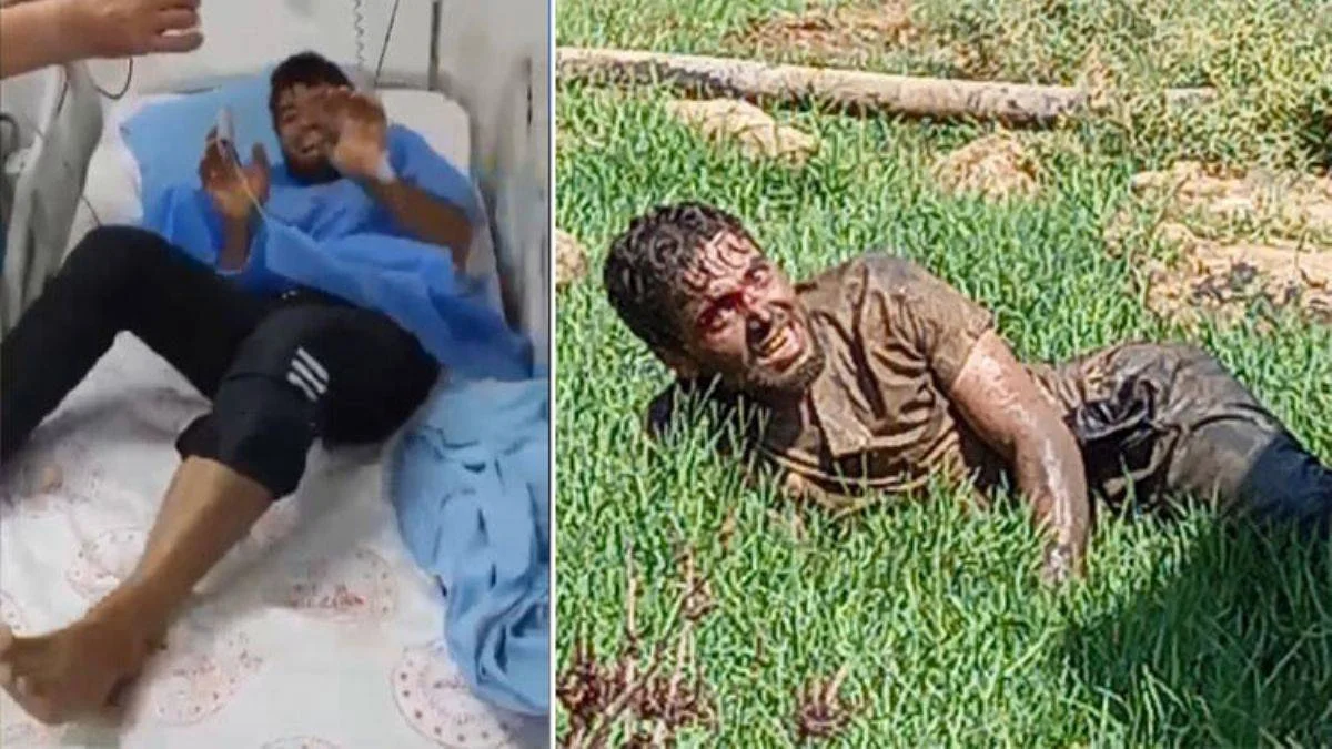 Kuduz tedavisi için ikna edilmişti, hastanede öldü