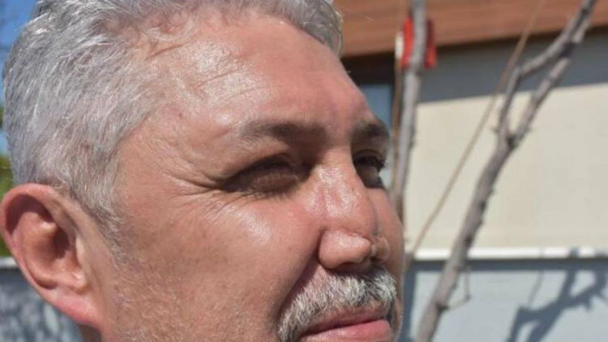 Okul arkadaşı doktor burnunu bu hale getirdi