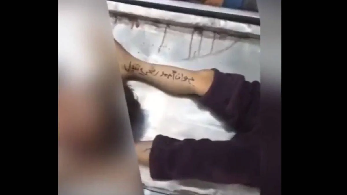 Gazzeli çocukların isimleri bacaklarına yazılıyor