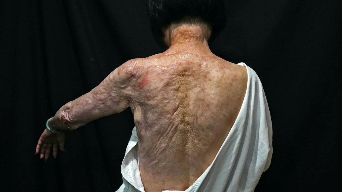 Ünlü fotoğrafçı Ut: Bu savaş, Vietnam Savaşı'ndan çok daha tehlikeli