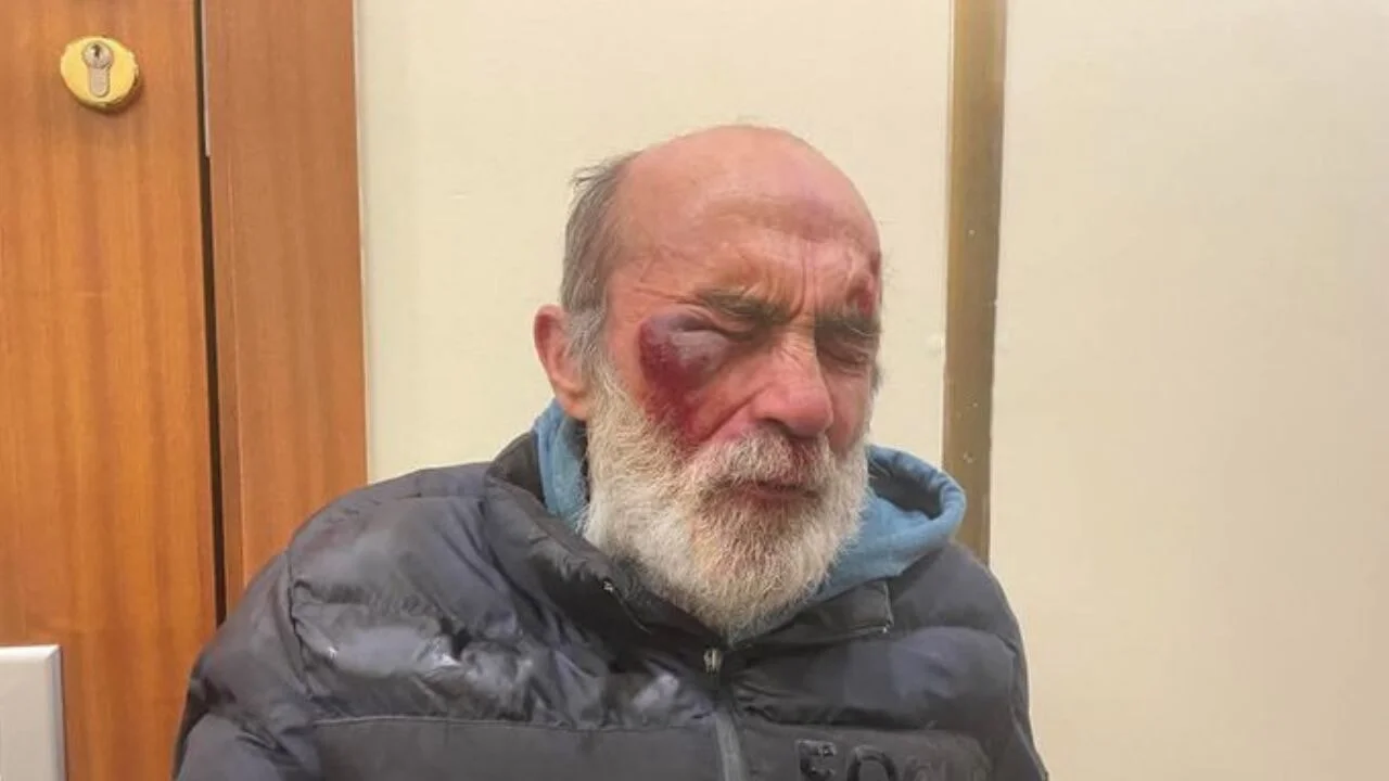 Polise asit atan saldırganın yakalandığı öne sürüldü