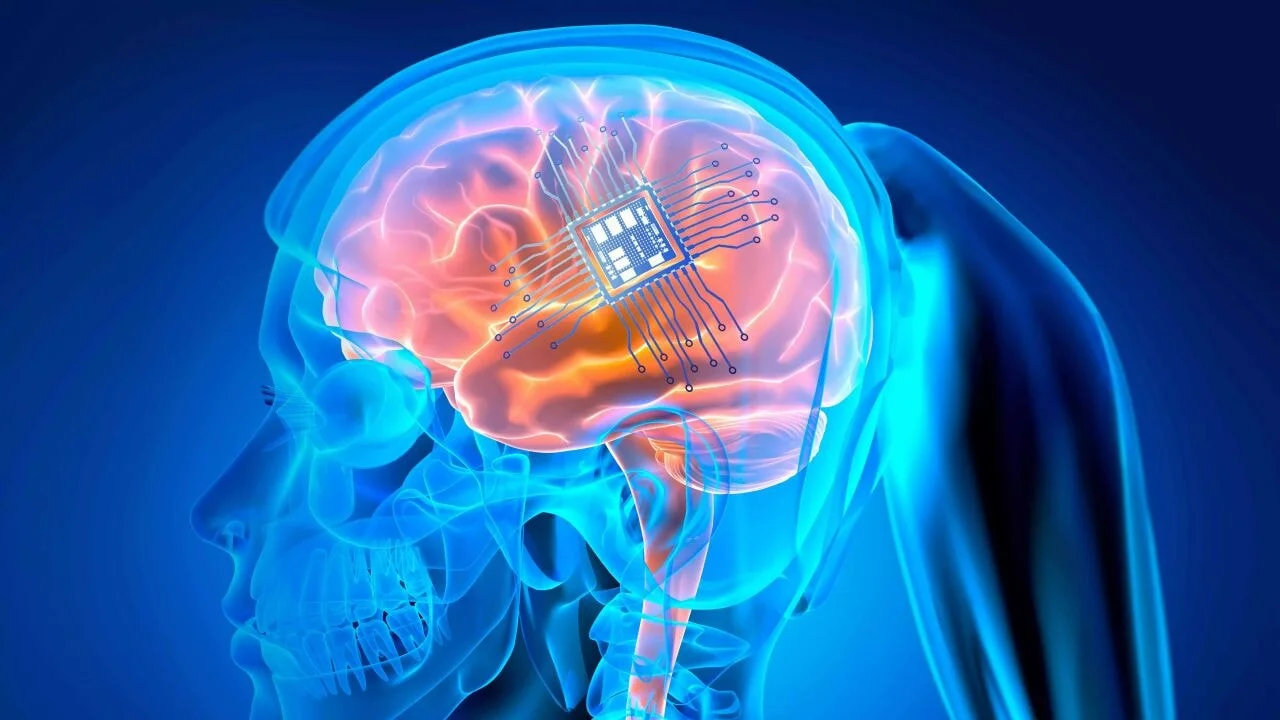 Beyin implantı, felçli kadının düşüncelerini seslendirdi!