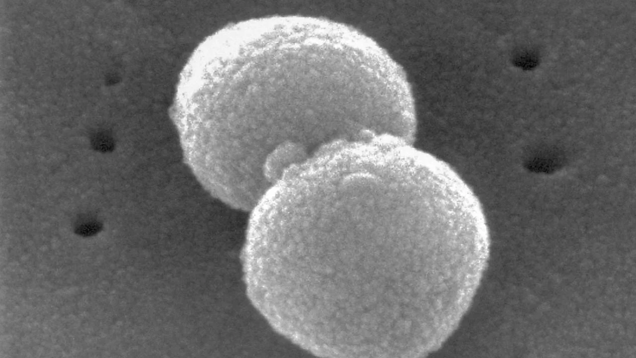 Süper bakteriye karşı antibiyotik geliştirildi