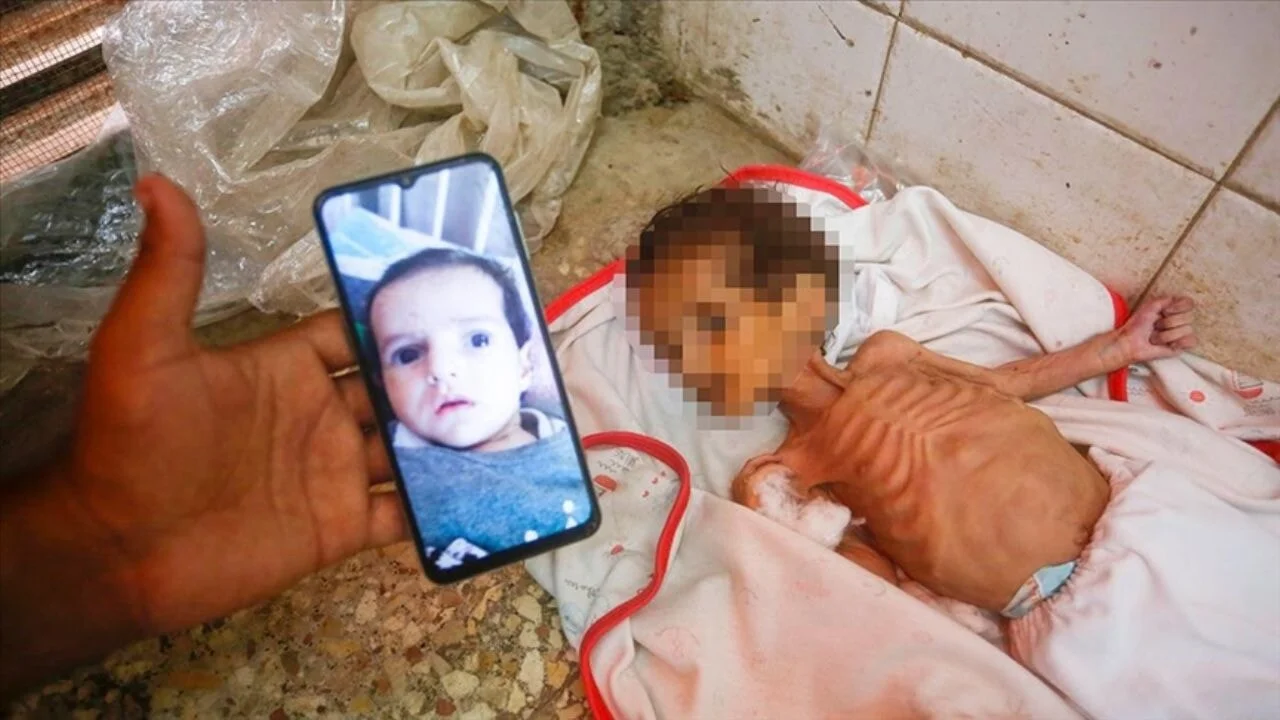 Gazze'de 3 aylık bebek Curi de açlıktan öldü
