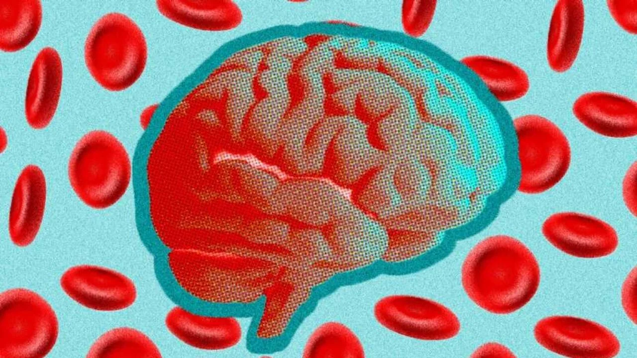 Alzheimer'ın nedeni beynin neresinde?